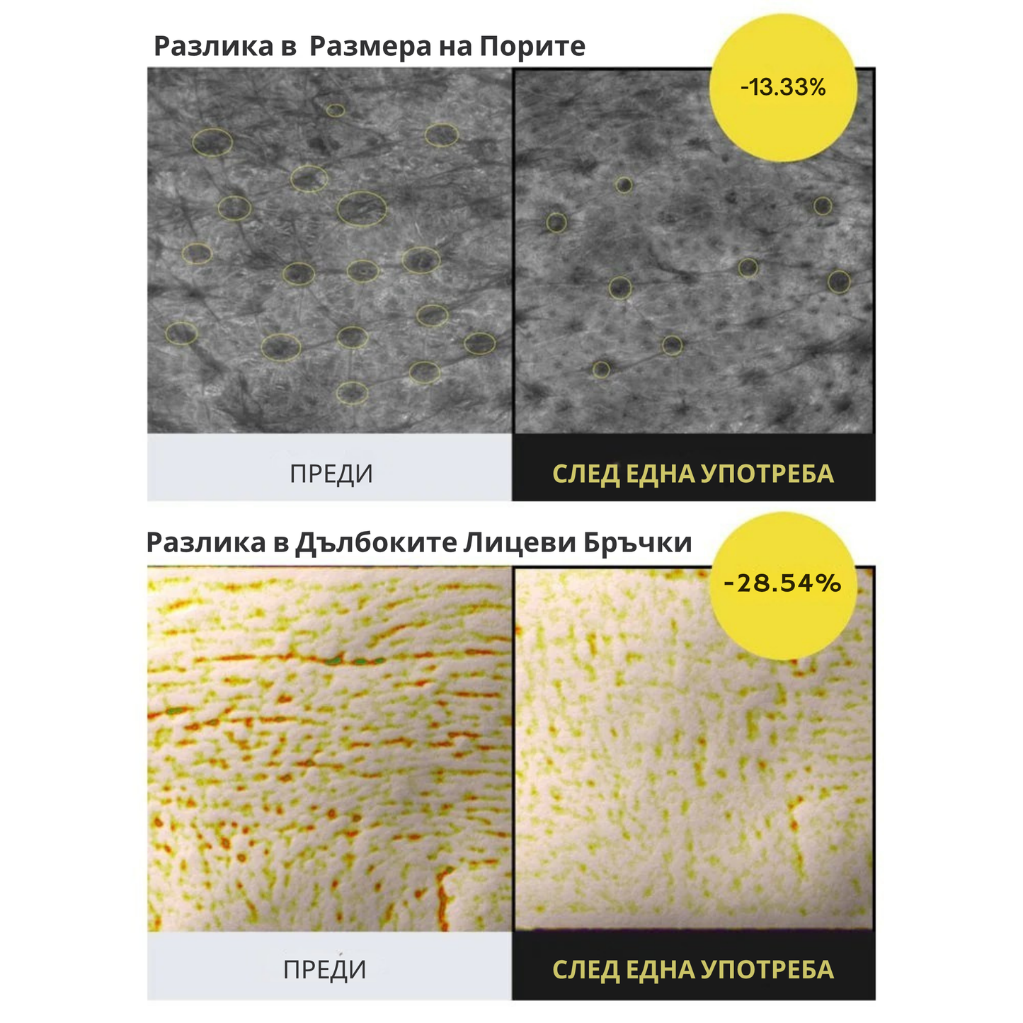 Renova™ Ретиналов Крем