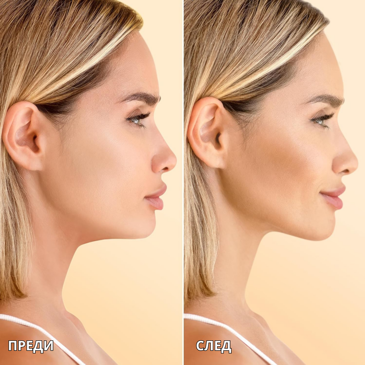 Renova™ V-Лифтинг Маска за Брадичка и Контур