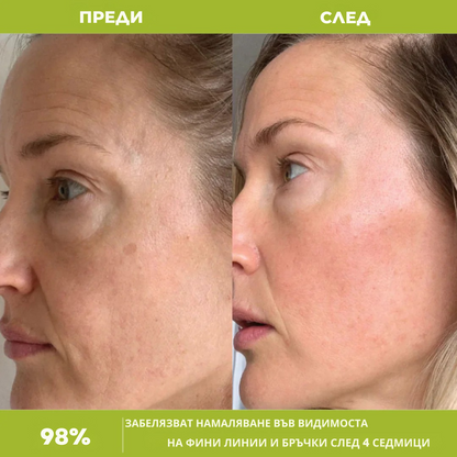 Renova™ Ретиналов Крем